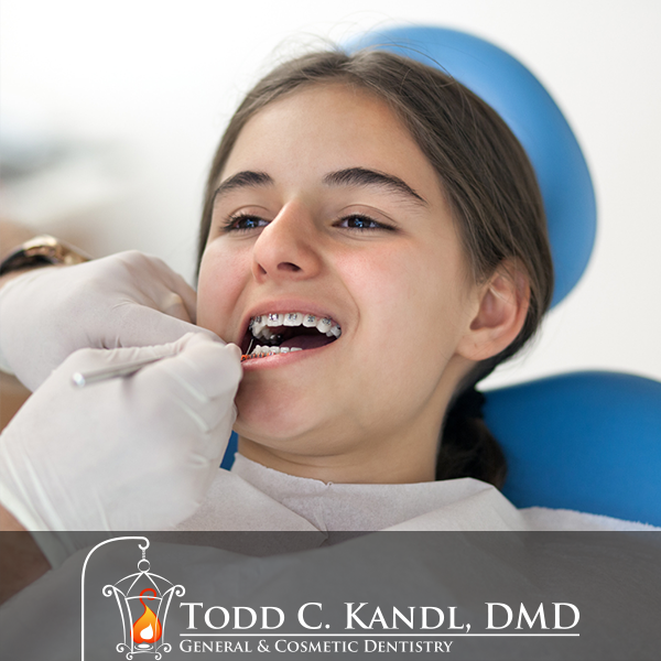 Teeth cleaning appointment for students Kandl Dental General and